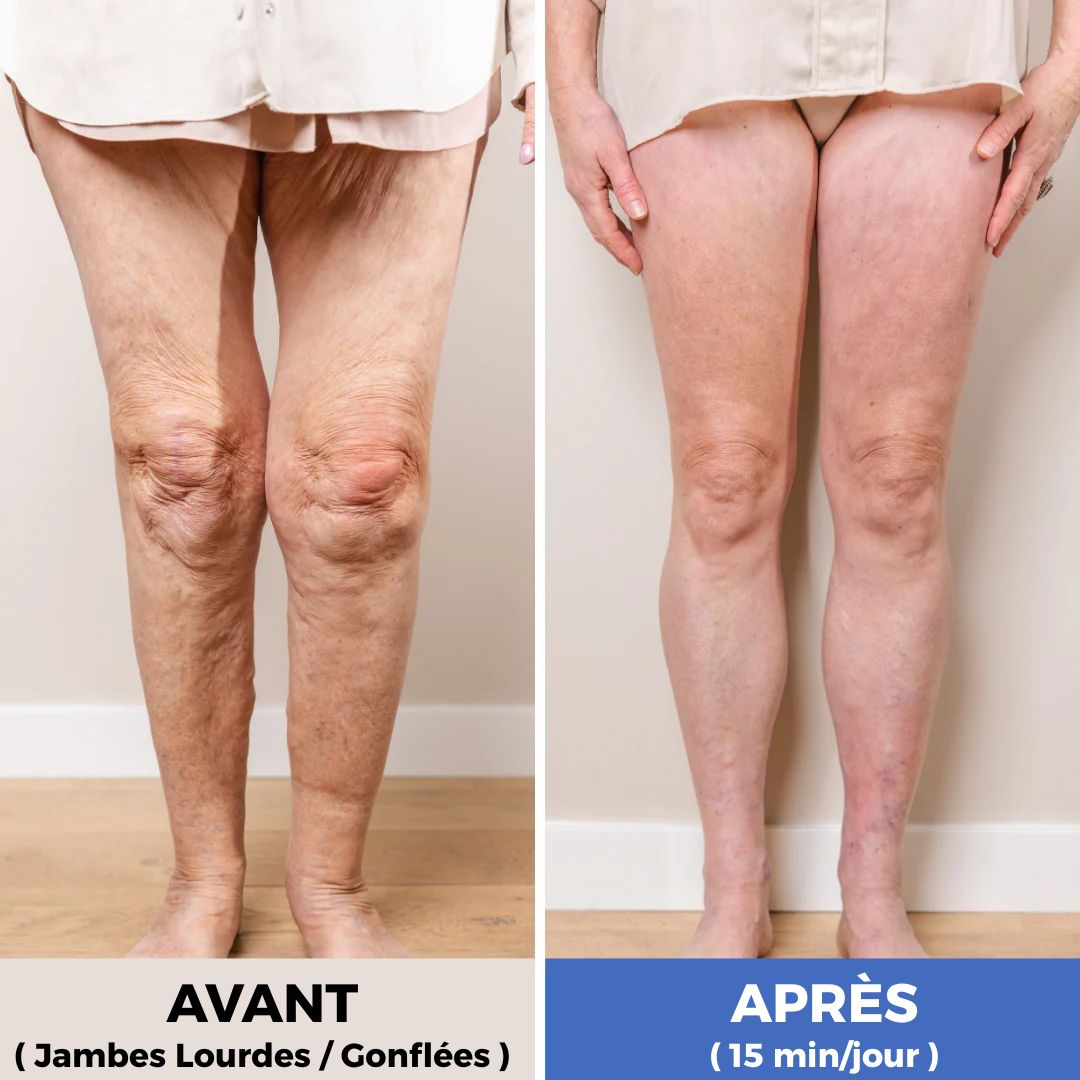 Elvora - Soulagez vos jambes lourdes chez vous