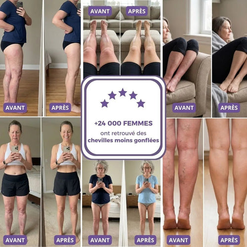 compression chaussette - Elvora